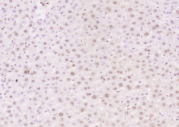 THRB1 Rabbit Polyclonal Antibody