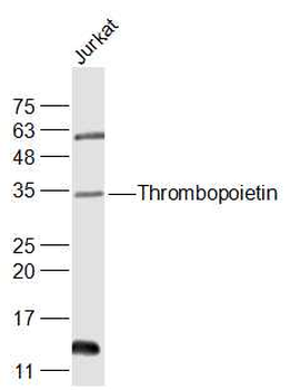 Thrombopoietin Rabbit Polyclonal Antibody