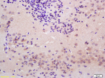 Thyroid peroxidase Rabbit Polyclonal Antibody