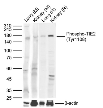 Phospho-TIE2 (Tyr1108) Rabbit Polyclonal Antibody