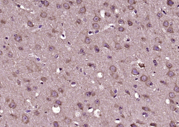 TIFA Rabbit Polyclonal Antibody