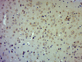 TIMP-2 Rabbit Polyclonal Antibody