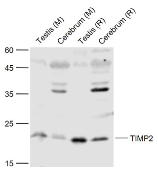 TIMP-2 Rabbit Polyclonal Antibody