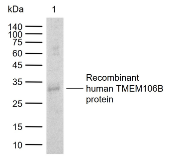 TMEM106B Rabbit Polyclonal Antibody