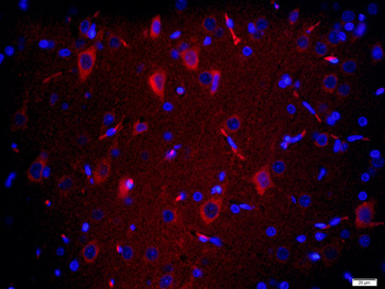 TMEM158 Rabbit Polyclonal Antibody