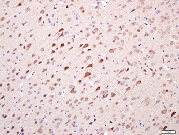 TMEM158 Rabbit Polyclonal Antibody