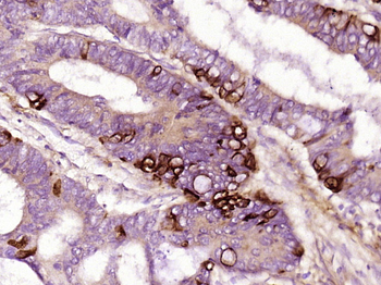 TMEM176A Rabbit Polyclonal Antibody