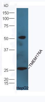 TMEM176A Rabbit Polyclonal Antibody