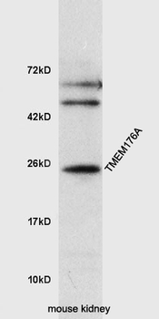 TMEM176A Rabbit Polyclonal Antibody
