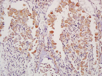 TMEM176A Rabbit Polyclonal Antibody