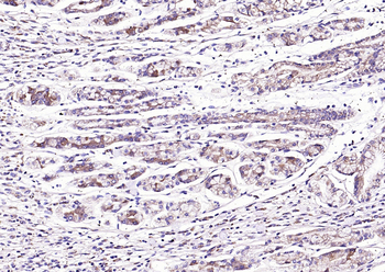 TMP21 Rabbit Polyclonal Antibody