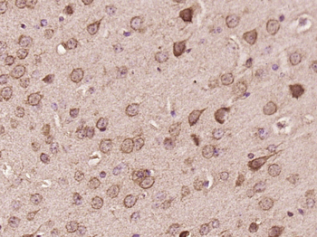 TMP21 Rabbit Polyclonal Antibody