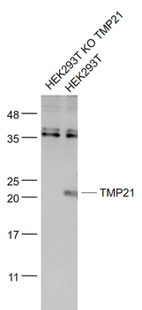 TMP21 Rabbit Polyclonal Antibody