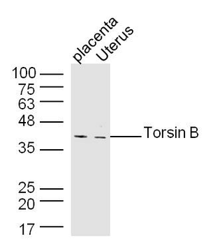 Torsin B Rabbit Polyclonal Antibody