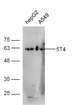 5T4 Rabbit Polyclonal Antibody