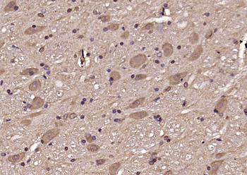 TPPP Rabbit Polyclonal Antibody