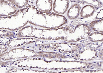 TRA1 variant Rabbit Polyclonal Antibody