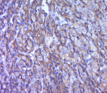 TREM1 Rabbit Polyclonal Antibody