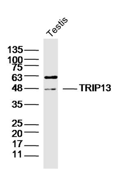 TRIP13 Rabbit Polyclonal Antibody