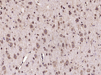 TrkA Rabbit Polyclonal Antibody