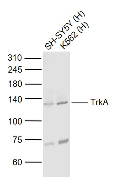 TrkA Rabbit Polyclonal Antibody