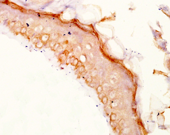 TYRP1 Rabbit Polyclonal Antibody