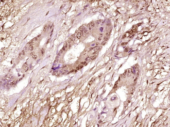 TRRAP Rabbit Polyclonal Antibody