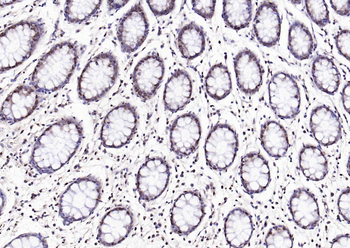 ASPSCR1 Rabbit Polyclonal Antibody