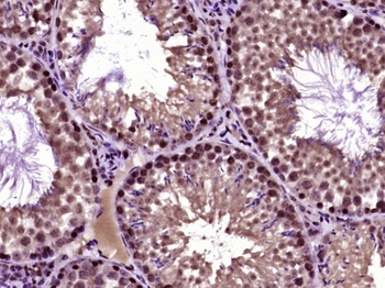 ASPSCR1 Rabbit Polyclonal Antibody