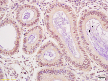 UBE3A Rabbit Polyclonal Antibody