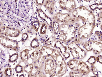 UBXD2 Rabbit Polyclonal Antibody