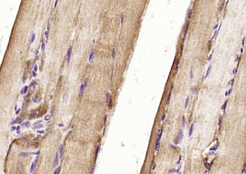 UCHL3 Rabbit Polyclonal Antibody
