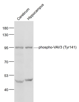 Phospho-VAV3 (Tyr141) Rabbit Polyclonal Antibody