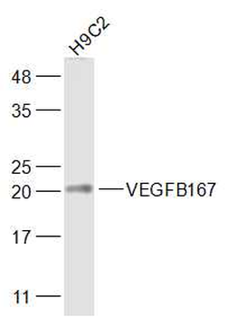 VEGFB167 Rabbit Polyclonal Antibody