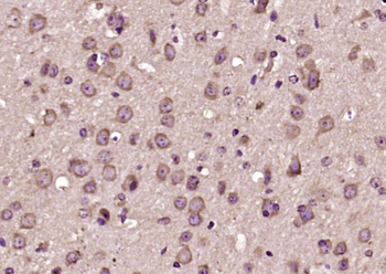 VGF Rabbit Polyclonal Antibody
