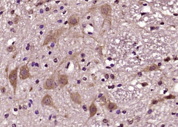 VGF Rabbit Polyclonal Antibody