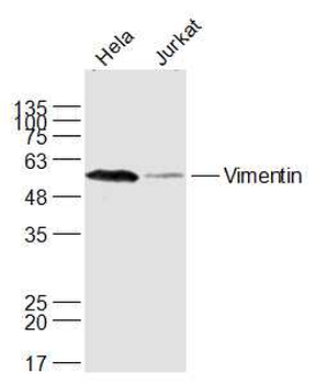 Vimentin Rabbit Polyclonal Antibody