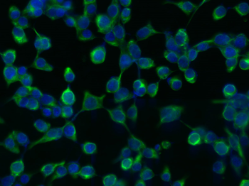 Vimentin Rabbit Polyclonal Antibody