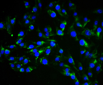 Vimentin Rabbit Polyclonal Antibody