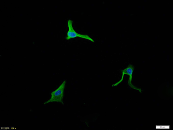 Vimentin Rabbit Polyclonal Antibody