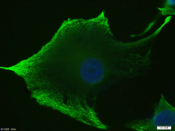 Vimentin Rabbit Polyclonal Antibody