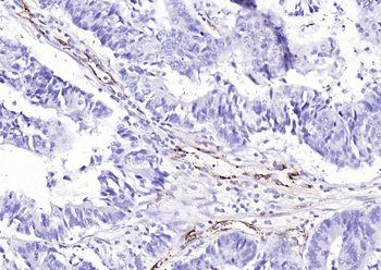 Von Willebrand Factor Rabbit Polyclonal Antibody