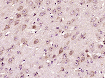 Von Willebrand Factor Rabbit Polyclonal Antibody