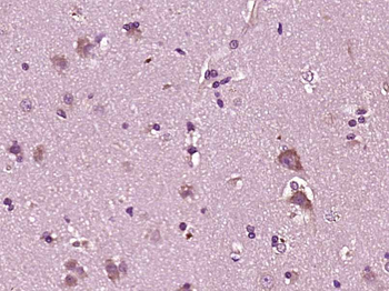 CHI3L2 Rabbit Polyclonal Antibody