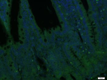 ZAK Rabbit Polyclonal Antibody