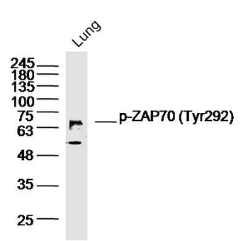Phospho-ZAP70 (Tyr292) Rabbit Polyclonal Antibody