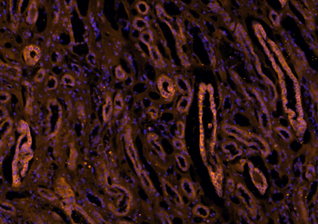 Pan Cytokeratin Rabbit Polyclonal Antibody (BF555)