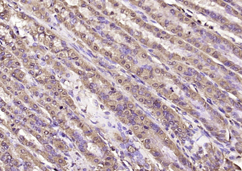 Phospho-ZCWCC1 (Ser739) Rabbit Polyclonal Antibody