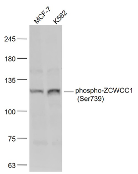 Phospho-ZCWCC1 (Ser739) Rabbit Polyclonal Antibody