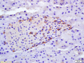 Phospho-ZCWCC1 (Ser739) Rabbit Polyclonal Antibody